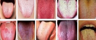 10 languages with different rashes