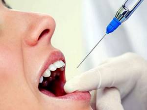 6 видов местной анестезии в стоматологии: что выбрать