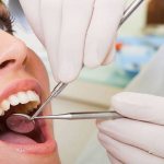 Адгезивные системы в стоматологии — особенности, принцип работы и отзывы