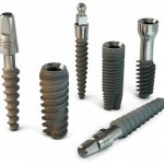 Альфа био импланты