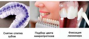 Альтернативные решения исправление кривых зубов винирами