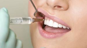 Анестезия при имплантации зубов