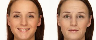 Do teeth whiten after quitting smoking?
