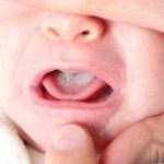 white coating on the baby&#39;s tongue