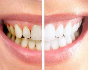 biorepair зубная паста 50 мл для чувствительных зубов
