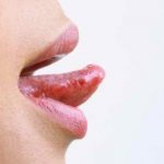 Болит кончик языка: причины, советы врачей