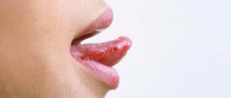 Болит кончик языка: причины, советы врачей