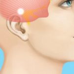 Болит правый висок и отдает в зуб