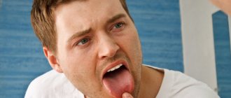 tongue hurts