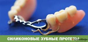 Частичные съемные зубные протезы
