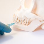 How to freeze a tooth at home