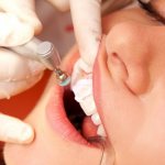 How long after brushing teeth from tartar can you eat and smoke? Why is there absolutely no way to do it? 