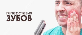 Что такое гиперстезия зубов