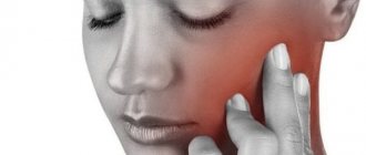 What is a parotid cyst?