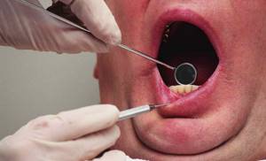 Диагностика кисты зуба