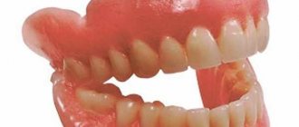 Эксперты о полиуретановом зубном протезе