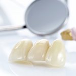 Этапы изготовления металлокерамического мостовидного протеза