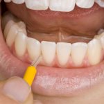 Stages of manufacturing plastic bridges