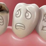 этиология и патогенез кариеса зубов