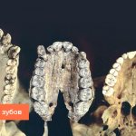 Photos of teeth at different stages of evolution