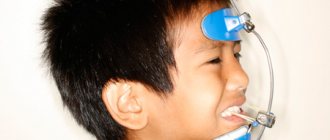 Functions of face masks in orthodontics