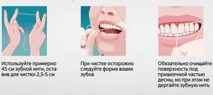 Гигиена полости рта для предотвращения болезней десен