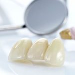 Характеристики стоматологической керамики