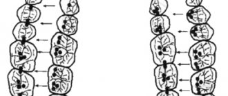 Идеальная окклюзия