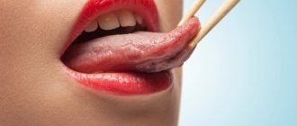 Change in tongue color: causes, treatment, diagnosis