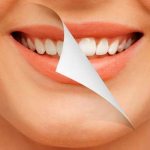 How to get rid of tartar at home