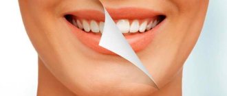 How to get rid of tartar at home