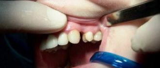 How to grow fangs and is it worth it?