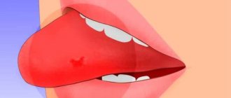 как остановить кровь из языка