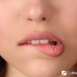 Как приподнять верхнюю губу чтобы было видно зубы?