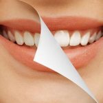 как удалить зубной налет