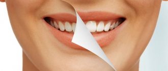 how to remove plaque
