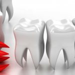 какие бывают Виды временных протезов на зубы