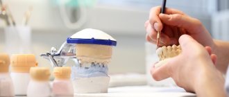 Какие материалы используются для изготовления зубных протезов