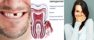 какие последствия могут быть при неправильном прикусе?