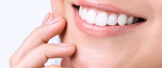 Ceramic dental crowns