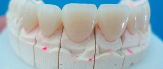 When does an orthodontist recommend correcting a bite with crowns?