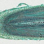 Кончик корня чехлик фото