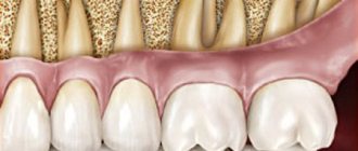 Roots of teeth at the bottom of the maxillary sinus
