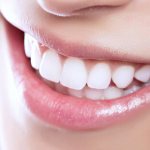 Красивая улыбка после отбеливаня зубов