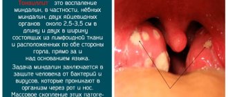 Люголь спрей для детей. Отзывы, инструкция по применению для горла, с какого возраста можно, цена