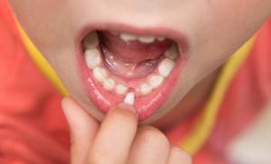 механическая травма зубов у детей