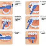 Методы чистки зубов