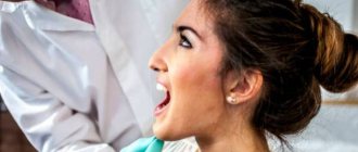 Mesial bite photo