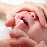 молочница опухли губы