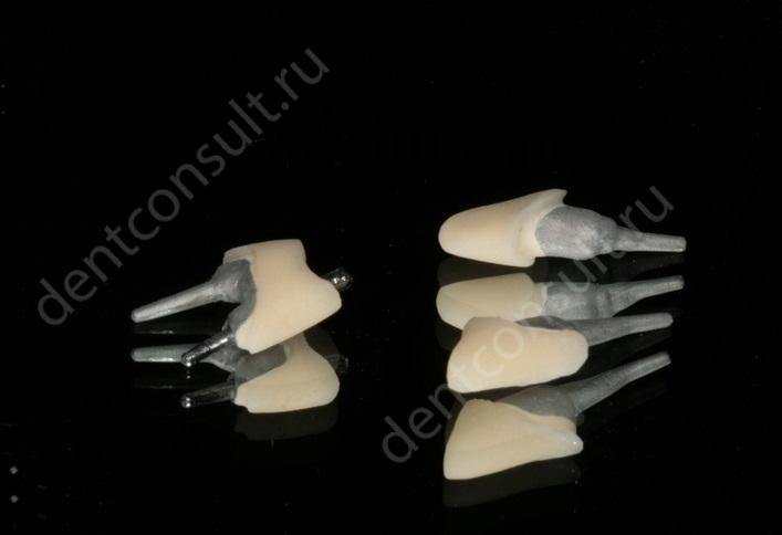 Установка зубных мостов в стоматологической клинике в Москве